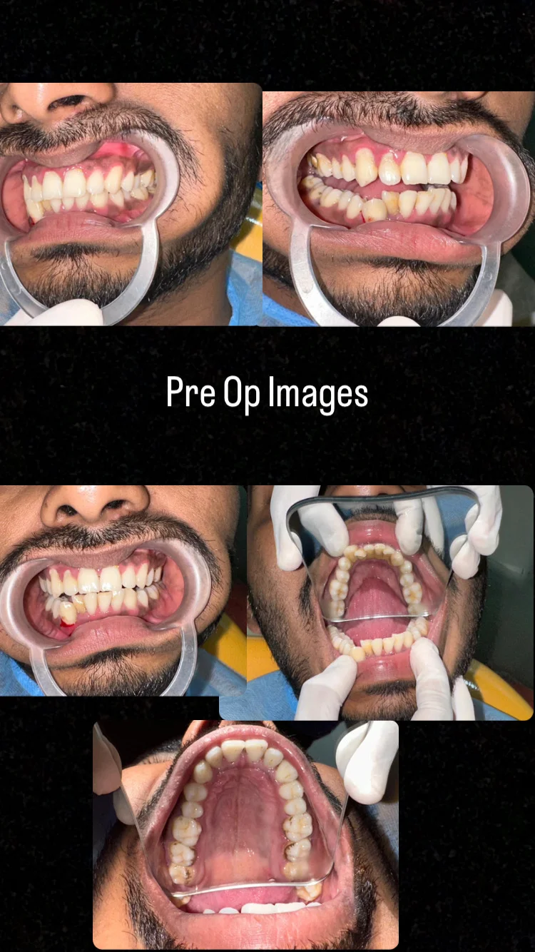 PRE OP IMAGES