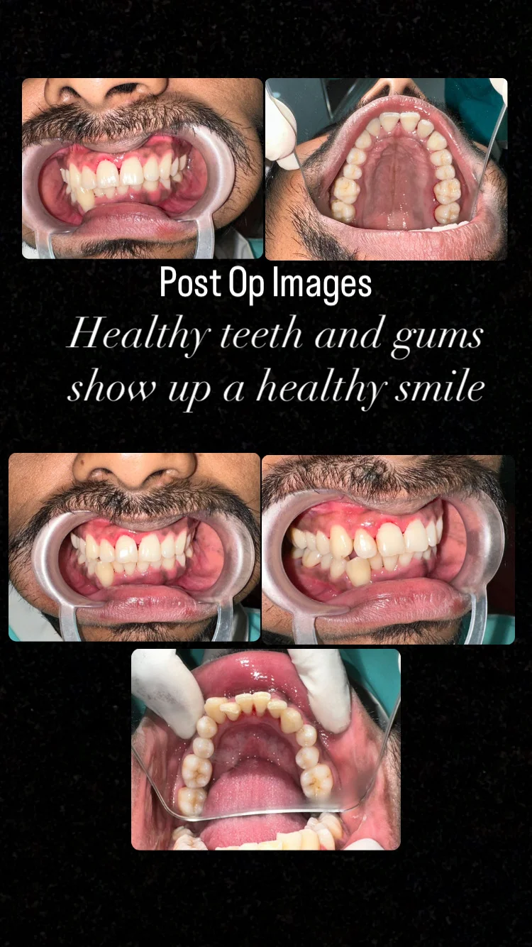 POST OP IMAGES