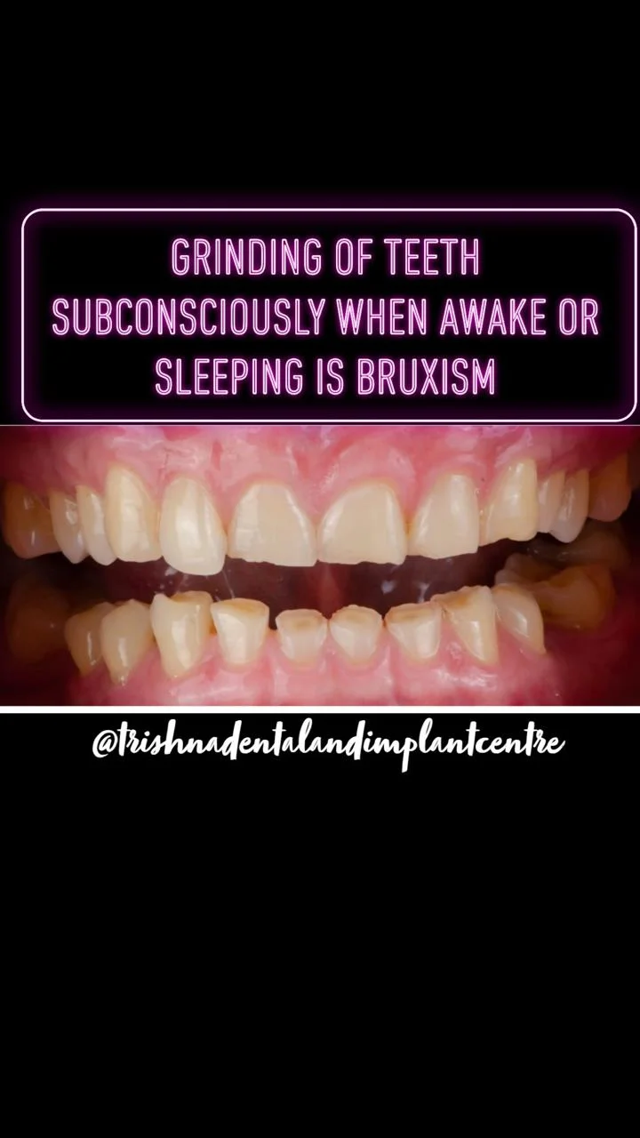 GRINDING OF TEETH